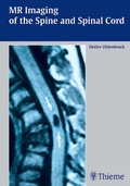 Cover: MR Imaging of the Spine and Spinal Cord - Thieme