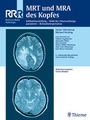 Cover: MRT und MRA des Kopfes - Thieme