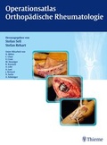 Cover: Operationsatlas Orthop&auml;dische Rheumatologie - Thieme