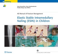 Abbildung von: Elastic Stable Intramedullary Nailing (ESIN) in Children - Thieme