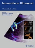 Cover: Interventional Ultrasound - Thieme