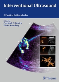 Abbildung von: Interventional Ultrasound - Thieme