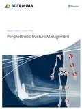 Cover: Periprosthetic Fracture Management - Thieme