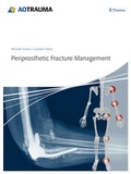 Cover: Periprosthetic Fracture Management - Thieme