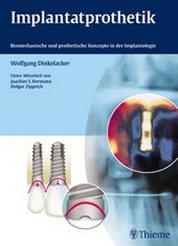 Abbildung von: Implantatprothetik - Thieme