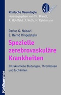 Cover: Spezielle zerebrovaskul&auml;re Krankheiten - Kohlhammer