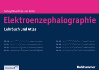 Abbildung von: Elektroenzephalographie - Kohlhammer
