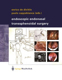 Abbildung von: Endoscopic Endonasal Transsphenoidal Surgery - Springer