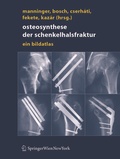Cover: Osteosynthese der Schenkelhalsfraktur - Springer