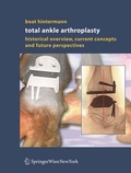 Bild: Total Ankle Arthroplasty - Springer