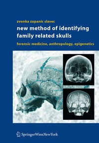 Abbildung von: New Method of Identifying Family Related Skulls - Springer