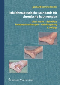 Abbildung von: Lokaltherapeutische Standards Fur Chronische Hautwunden - Springer
