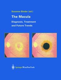 Enlarge image Cover: The Macula - Springer