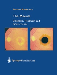 Enlarge image Cover: The Macula - Springer