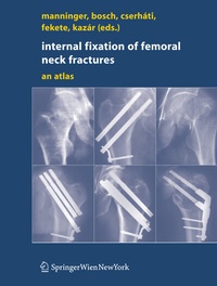 Abbildung von: Internal fixation of femoral neck fractures - Springer