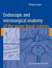 Abbildung von: Endoscopic and microsurgical anatomy of the upper basal cisterns - Springer