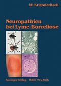 Cover: Neuropathien bei Lyme-Borreliose - Springer