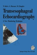 Abbildung von: Transesophageal Echocardiography - Springer