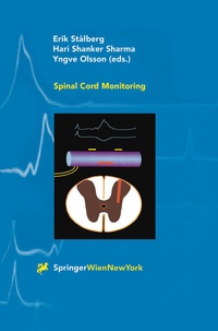 Bild: Spinal Cord Monitoring - Springer