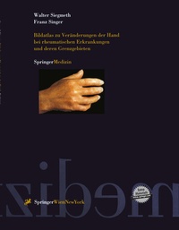 Abbildung von: Bildatlas zu Veränderungen der Hand bei rheumatischen Erkrankungen und deren Grenzgebieten - Springer