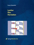Bild: Lumbar Disc Herniation - Springer