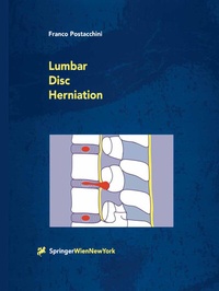 Bild: Lumbar Disc Herniation - Springer