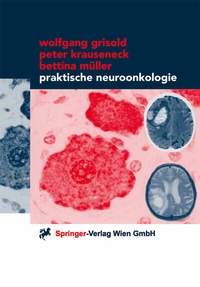 Abbildung von: Praktische Neuroonkologie - Springer