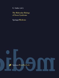 Abbildung von: The Molecular Biology of Down Syndrome - Springer