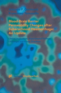 Bild: Blood-Brain Barrier Permeability Changes after Subarachnoid Haemorrhage: An Update - Springer