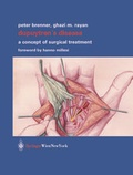 Cover: Dupuytren's Disease - Springer