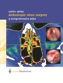 Bild: Endoscopic Sinus Surgery - Springer