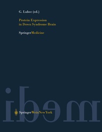 Abbildung von: Protein Expression in Down Syndrome Brain - Springer