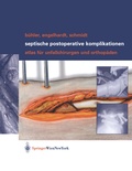 Cover: Septische postoperative Komplikationen - Springer