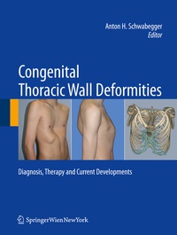 Abbildung von: Congenital Thoracic Wall Deformities - Springer
