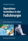 Cover: Operationstechniken in der Fu&szlig;chirurgie - Springer
