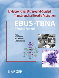 Abbildung von: Endobronchial Ultrasound-Guided Transbronchial Needle Aspiration (EBUS-TBNA): A Practical Approach - S. Karger