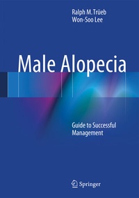 Abbildung von: Male Alopecia - Springer