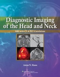 Cover: Diagnostic Imaging of the Head and Neck - Lippincott Williams and Wilkins