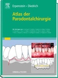 Cover: Atlas der Parodontalchirurgie - Urban & Fischer