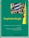 Cover: Praxis der Zahnheilkunde - PdZ. Strukturiert nach dem PermaNova-Verfahren / Implantologie - Urban & Fischer