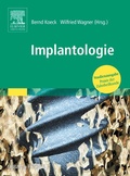 Cover: Implantologie - Urban & Fischer