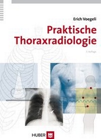 Abbildung von: Praktische Thoraxradiologie - Hogrefe