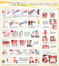 Abbildung von: Taping Wandtafel Krankheitsbilder - Urban & Fischer