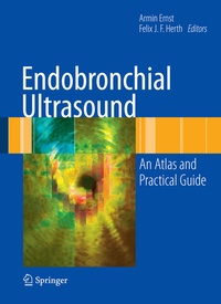 Abbildung von: Endobronchial Ultrasound - Springer