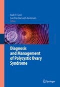 Cover: Diagnosis and Management of Polycystic Ovary Syndrome - Springer