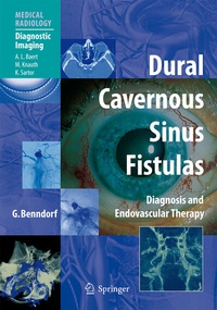 Abbildung von: Dural Cavernous Sinus Fistulas - Springer