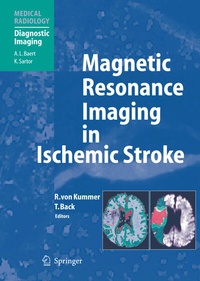 Abbildung von: Magnetic Resonance Imaging in Ischemic Stroke - Springer