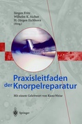Cover: Praxisleitfaden der Knorpelreparatur - Springer
