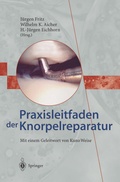 Cover: Praxisleitfaden der Knorpelreparatur - Springer