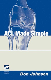 Abbildung von: ACL Made Simple - Springer